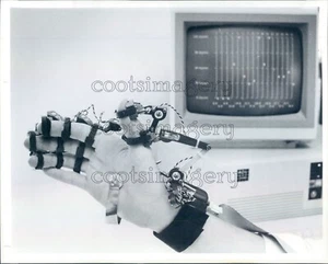 1988 Press Photo Computer & Sensors Measure Joint Motion in Hand - Picture 1 of 2