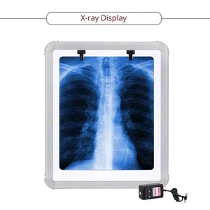 LED X-Ray Film Viewer Box SMALL(14''X17'') LARGE with free shipping - Picture 1 of 6