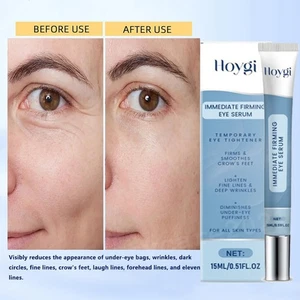 Crema de ojos antienvejecimiento para ojeras bolsas de ojos, líneas finas, hinchazón de arrugas - Imagen 1 de 12