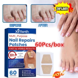 60x Anti Fungal Nail Treatment Patches Toe Fungus Onychomycosis Repair StickersN - Picture 1 of 12