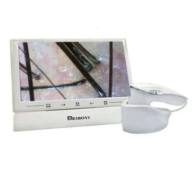 Cámara digital microscopio de piel para folículos capilares profesionales de 11"" para cuero cabelludo Foto 1 de 4