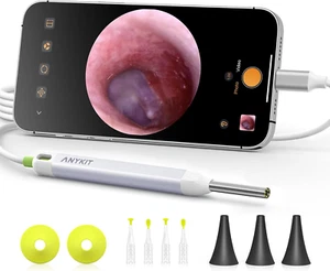 Otoscopio Digital HD con Luz y Giroscopio für Android/iPhone 15 - Bild 1 von 12