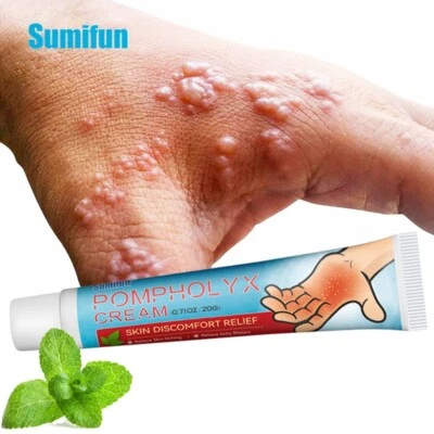 SUMIFUN New Sweat Herpes Treatment Cream Relieve Skin Itching Ointment Hand Desquamate