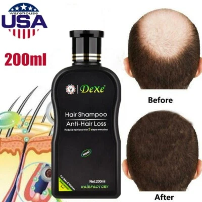 Champú para el crecimiento del cabello DEXE champú para el crecimiento del cabello champú para hombres y mujeres Foto 1 de 4