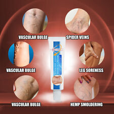 20g Varicose Cream Varicose Veins Cream Phlebitis Angiitis Removal Legs Vein Hoi