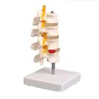 Human Anatomical Lumbar Disc Herniation Vertebral Spine Anatomy Skeleton Model