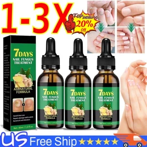7 Tage Nagelpilz Behandlung All Natural Formula Gingers Nagel Zehennagelpflege 30ml] - Bild 1 von 18