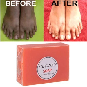 Kojic Acid Soap Dark Skin Whitening Bleaching Lightening Brightening Face & Body - Picture 1 of 17