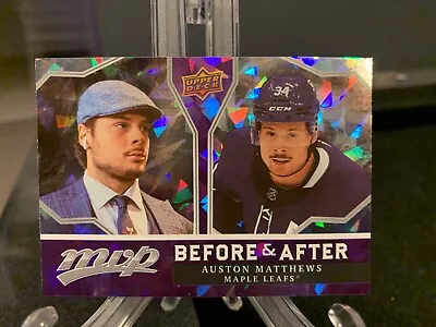 Auston Matthews 2021-22 UD MVP Before & After # BA-1 - Toronto Maple Leafs - Image 1 of 2