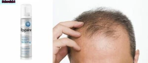 KOSTENLOSER KOSTENLOSER VERSAND * ROGAINE FÜR MÄNNER HAARSCHAUM - 1 Dose - kaufen und sparen - Bild 1 von 1
