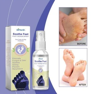 Foot Scrub Spray Removes Foot Fungus And Odor To Promote Foot Health✨ - Picture 1 of 17