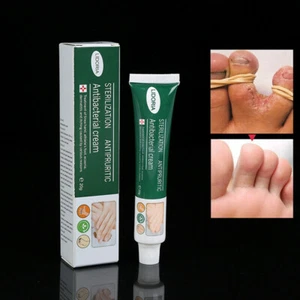 20/40/60g Crema para pies antihongos Desodorante Crema Antibacteriana para pies Anti Picazón - Imagen 1 de 10