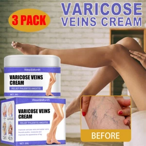 3PCS Vein Care Fading Cream Varicose Veins Cream for Legs Veins Herbal Ointment - Picture 1 of 10