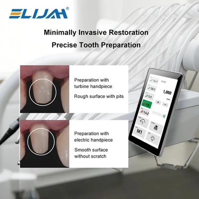 Dental LED Touch Screen Micro Motor Inner Water Spray Type Electric Brushlesss - Image 1 of 4