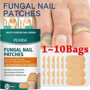 32 ~ 320 Stück Nagelpilzpflaster - extra starke Zehennagelpilzbehandlung über Nacht - Bild 1 von 21