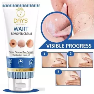 7 Days Genital Wart Removal Cream for Men & Women 50g - Picture 1 of 7