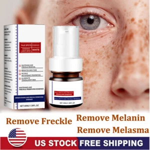 Effective Whitening Freckle Cream Remove Dark Spot Cream Removal Melanin Melasma - Picture 1 of 20