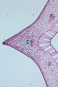 Microscope antique diapositive par Hornell. T.S. Feuille de Sarracenia. (Usine de pichet).