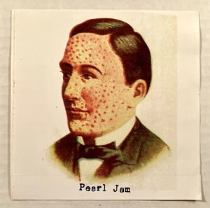 PEARL JAM RARO VINTAGE AÑOS 90 HOMBRE CON SARAMPIÓN PEGATINA - Imagen 1 de 2