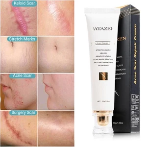 Crema para cicatrices quirúrgicas, cesárea, estrías, cicatriz queloide, cicatriz para acné - Imagen 1 de 6