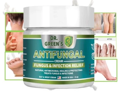 DRGREENS ANTIFUNGAL Natural Antifungal Toenail Nail Fungus support Cream ringworm jock itch 2 fl oz