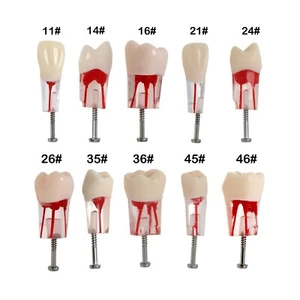 Modelo dental Kilgore Nissin dientes tipodonte conducto radicular práctica modelo bloque 10 un. - Imagen 1 de 78
