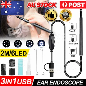 LED Ear Cleaner Endoscope Camera Otoscope Scope Pick Ear Wax Removal Tool USB - Picture 1 of 8