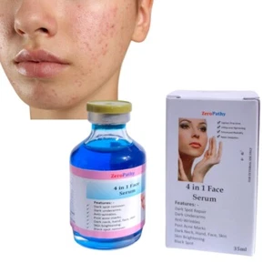 Skin Tag & Warzenentferner Gel 35ml - reinigt Muttermale, spendet Feuchtigkeit & hellt auf - Bild 1 von 6