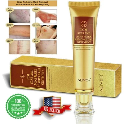 ALIVER TCM SCAR AND ACNE MARK REMOVAL GEL OINTMENT Acne Scar Burns Cream USA - Image 1 of 4