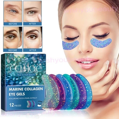 Under Eye Patches for Dark Circles & Puffy Eyes (6 Pairs/12PCS) Marine Collagen - Image 1 of 4