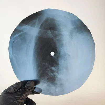 PINK FLOYD NARROW WAY p3 X-Ray USSR Record Roentgen Bone Ribs Music Vinyl Foto 1 de 2