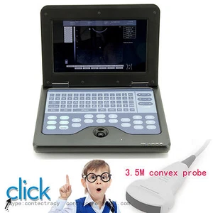 Portable Notebook Laptop Ultrasound machine Scanner system Digital,CONVEX probe - Picture 1 of 11