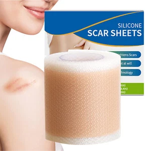 Scar Silicone Sheet Gel Patch Removal Skin Treatment Repair Wound Burn Natural - Picture 1 of 10