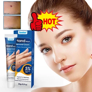 Genital Wart Removal Cream for Men & Women -20g Salicylic Acid Wart Cream Hot - Picture 1 of 18