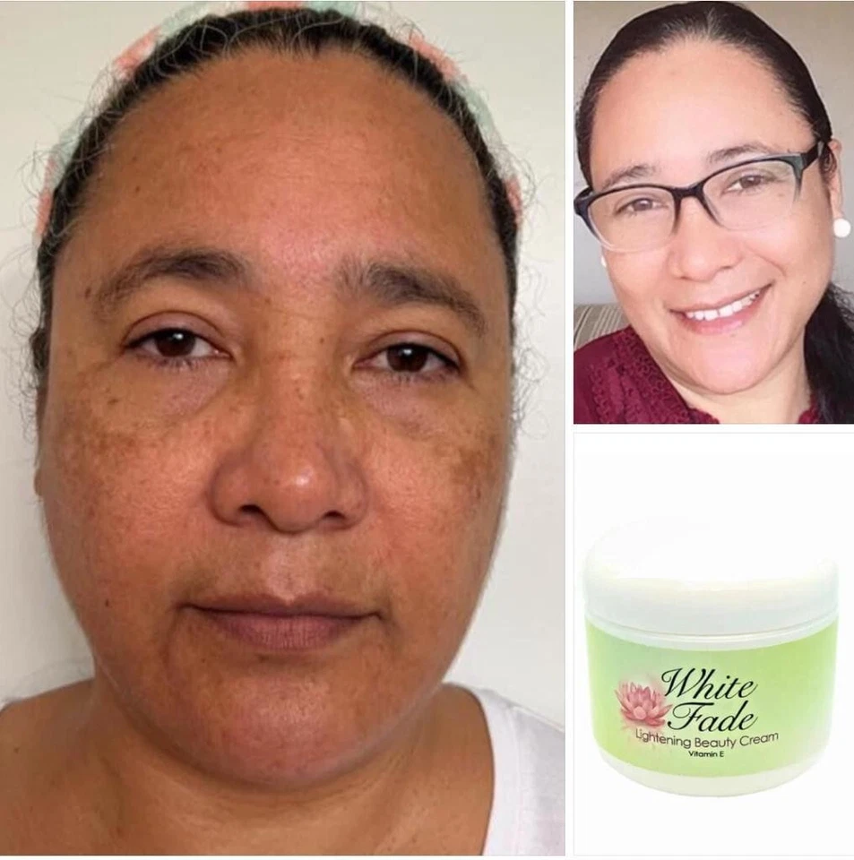 JACVON LLC W.F.C : Eliminan Las Manchas Oscuras, Especial Para Piel Morena o Triguena 2oz.