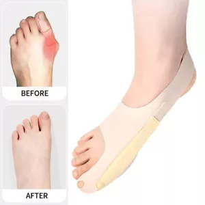 1PC Hallux Valgus Toe Bunion Corrector Adjustable Orthopedic Socks Women - Bild 1 von 11