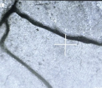 ✨SPECIAL FIND-weak /NO FG ERROR ✨1972 D Kennedy Half Dollar w/DIE CLASH-TWINS😎 - Image 1 of 4