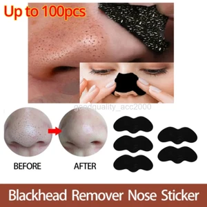Up 100pc Blackhead Remover Nose Face Mask Strips Black Head Pore Acne Clean Mask - Picture 1 of 7