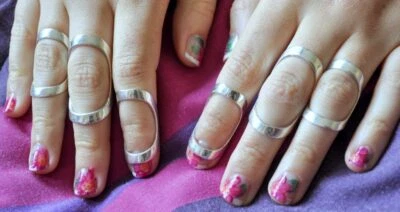 Arthritis EDS finger splint adjustable for all types of deviation Mallet Finger - Image 1 of 4