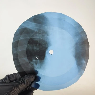 DAVID BOWIE LET ME SLEEP BESIDE X-Ray USSR Record Roentgen Bone Ribs Music Vinyl - Image 1 of 2