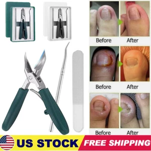 Eagle Beak Nail Clippers,Eagle Beak Beveled Nail Clippers,Sets Of Luxury Eagle - Picture 1 of 24