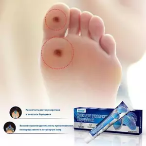 Plantar Wart Removal Cream Foot Wart Removal Cream K6Q4 - Picture 1 of 12