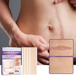 8x Silicone Scar Sheets Soften Flatten Scar Stretch Marks Scar Removal Treatment - Picture 1 of 12