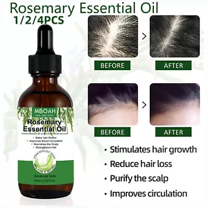 Rosemary Essential Oil for Hair Growth Anti Loss Regrow Treatment Dry Scalp - Picture 1 of 12