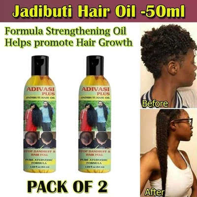 Fast Hair Growth Oil Traction Alopica Promotes Hair Growth 50ML - Pack of 2 - Image 1 of 4