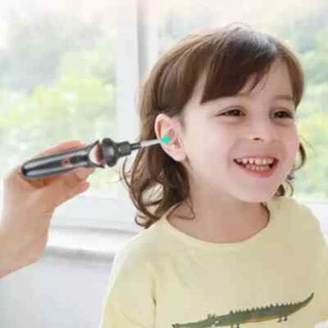 Ear Spoon Replacement For NE3 Wireless Smart Visual Ear Cleaner Otoscope Ear Wax - Picture 1 of 5
