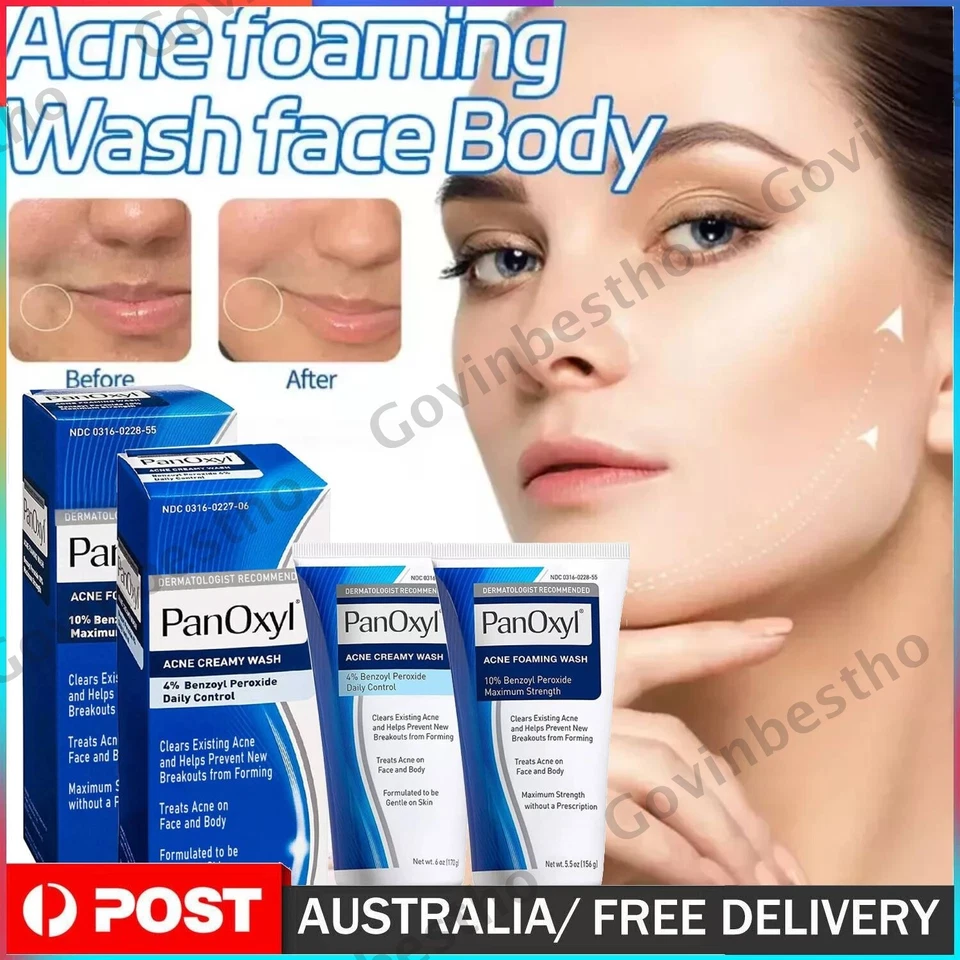 Moisture Benzoyl Peroxide 10% Foaming Acne Wash Skin Care 4% Daily Control Cream - image 1 of 4