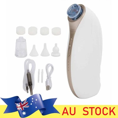 Ear Vacuum Wax Remover Detachable Rechargeable 3 Suction Levels Ear Wax Removal - image 1 of 4