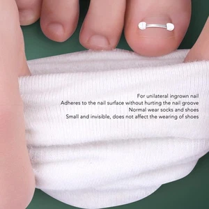 Ingrown Toenail Corrector Strips Stainless Steel Free Cutting Ingrown Toenai BAK - Bild 1 von 24