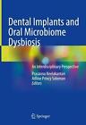 Implants dentaires et dysbiose du microbiome buccal : une perspective interdisciplinaire 